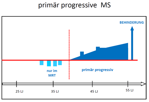 primär progressive Multiple Sklerose