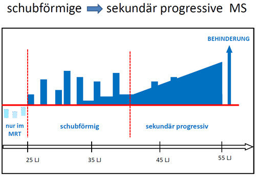 schubförmige > sekundär progressive Multiple Sklerose