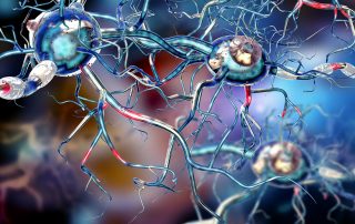 Bei der Multiplen Sklerose greift das Immunsystem die Myelinhülle der Nervenfasern an (weiß), Credit: Ralwel/iStockphoto