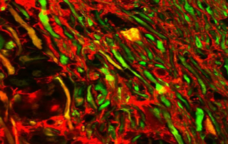 Mikroskopische Aufnahme des Rückenmarks: Geschädigte Nervenfasern nehmen einen roten Fluoreszenzfarbstoff auf, Axone ohne Farbstoffaufnahme erscheinen grau. Bild: Witte et al.