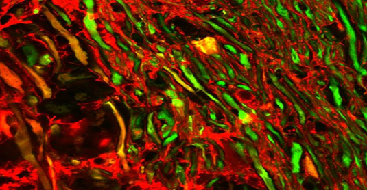 Mikroskopische Aufnahme des Rückenmarks: Geschädigte Nervenfasern nehmen einen roten Fluoreszenzfarbstoff auf, Axone ohne Farbstoffaufnahme erscheinen grau. Bild: Witte et al.